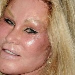 Six Worst Celebrity Cosmetic Surgery DISASTERS