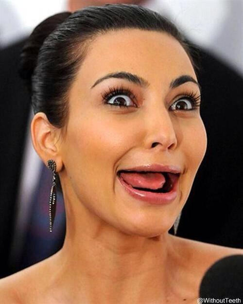 kim kardashian without teeth