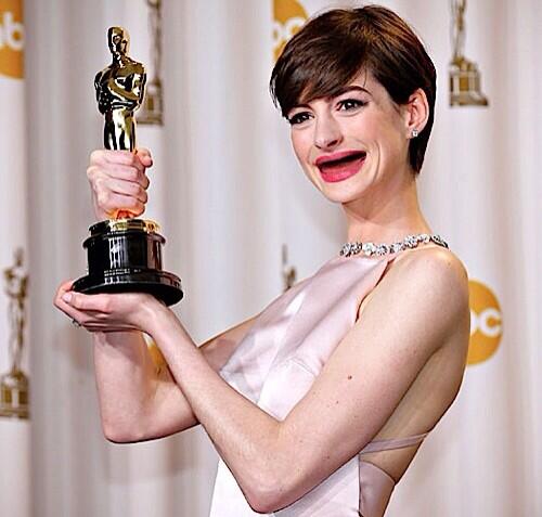 anne hathaway without teeth