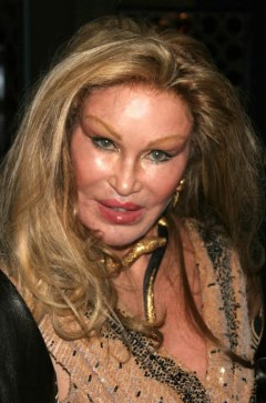 Six MAJOR Celebrity Cosmetic Surgery Disasters!