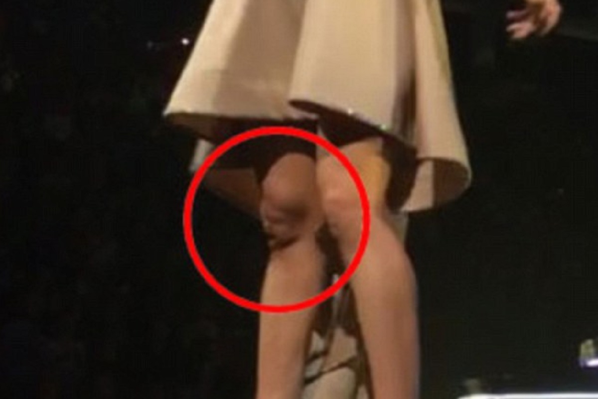 Carrie Underwood Knee