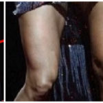 Carrie Underwood's Knee