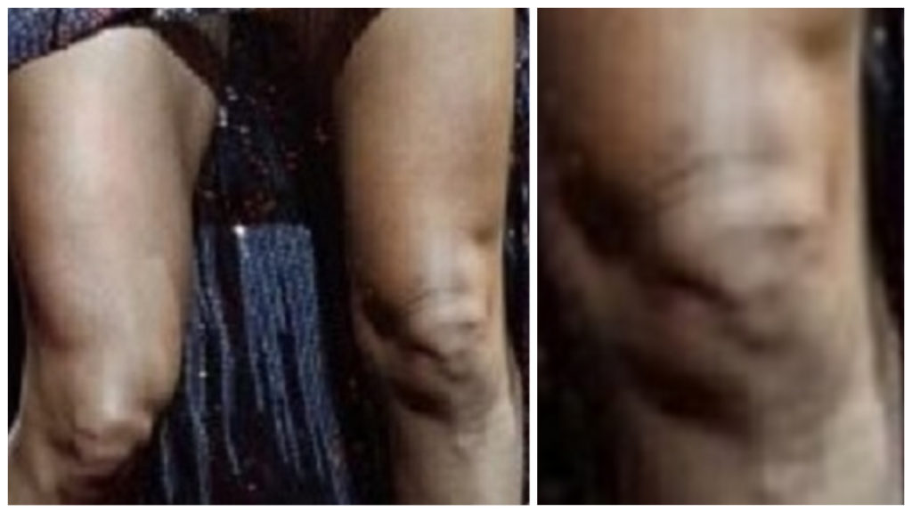 Carrie Underwood's Knee