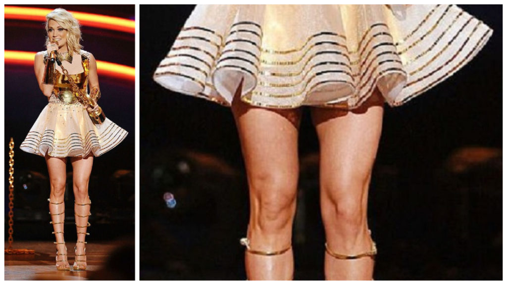 Carrie Underwood Knee