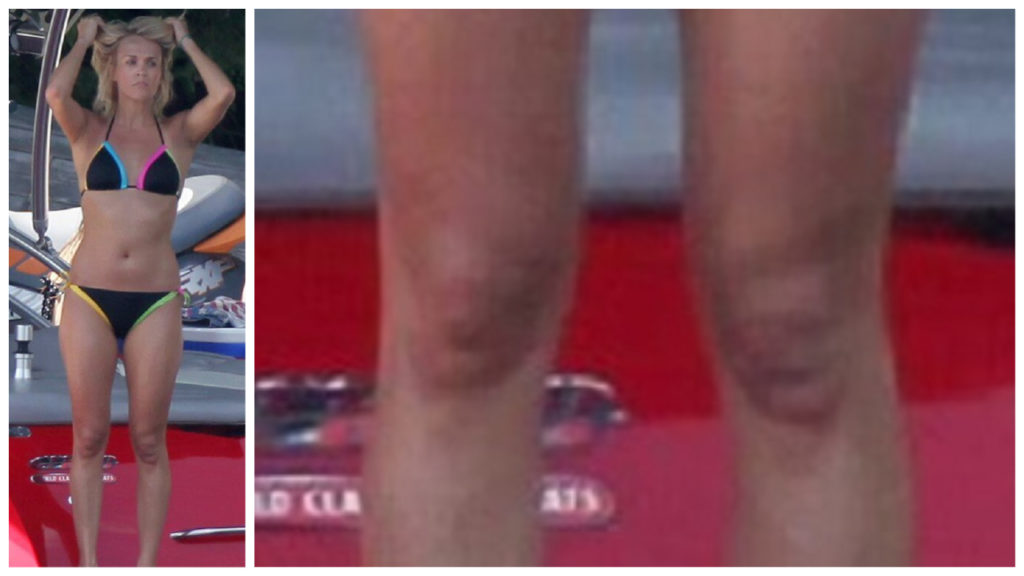 Carrie Underwood's Knees