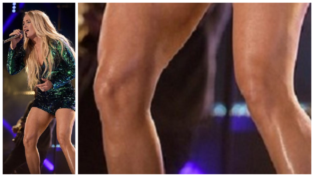 Carrie Underwood's Knees